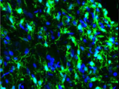 Клетки помогут лечить заболевания нервной системы