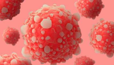 Медики нашли возможные причины появления рака кишечника