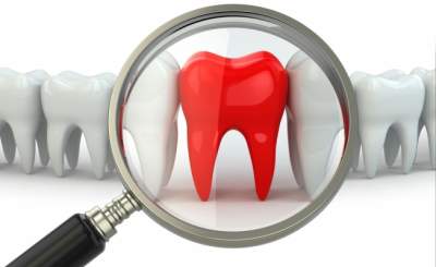 Стоматолог рассказал, как избежать потери зубов