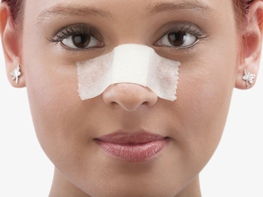 5 советов по уходу за носом после ринопластики