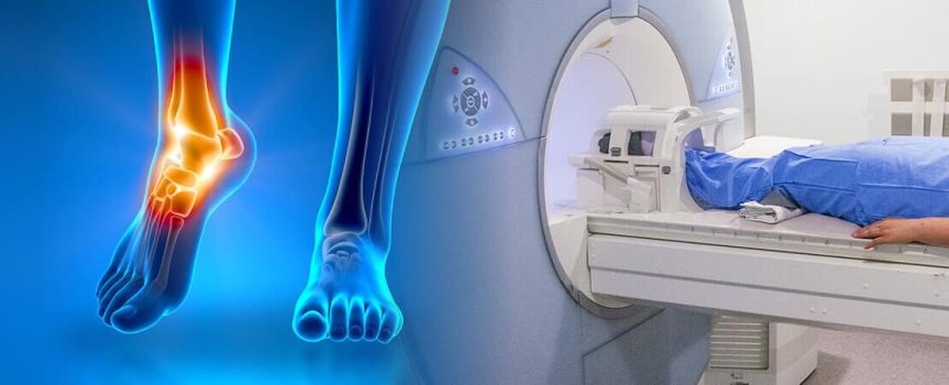 Где можно сделать МРТ голеностопного сустава в Виннице/Киеве?