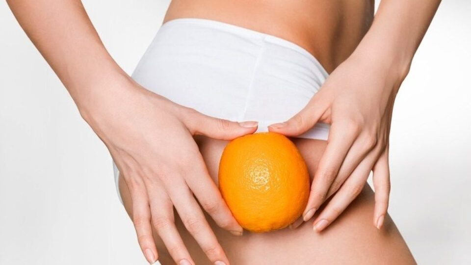 Целлюлит: правила профилактики и борьбы с «апельсиновой коркой»