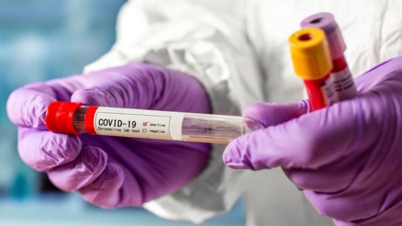 Названы самые распространенные симптомы коронавируса в Украине